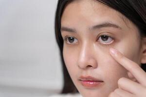 Eye problems Asian women open eyes due to eye irritation, eye rubbing, dry, eye pain after work, migraine, headache, blurred vision, photophobia, working in the dark, blue light from computer screens photo