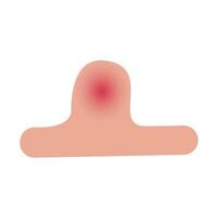 Illustration of an Pimple on Skin vector