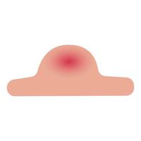 Illustration of an Inflamed Pimple on Skin vector