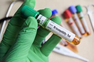 Rh Incompatibility - Test with blood sample in green gloved hands. healthcare or Medical concept photo