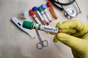 High Sensitive CRP - Test with blood sample in yellow gloved hands. healthcare or Medical concept photo