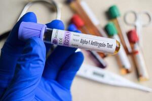 Alpha1 Antitrypsin - Test with blood sample in blue gloved hands. healthcare or Medical concept. photo