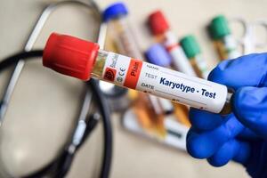 Karyotype - Test with blood sample in blue gloved hands. healthcare or Medical concept photo