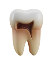 Decayed Molar with a Cavity Minimalist 3D Rendering Soft And Smooth Renderer png