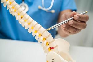 doctor holding spinal nerve and bone model, Lumbar spine displaced herniated disc fragment for treatment medical orthopedic photo