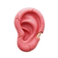 A pink ear with cracks and a broken section is displayed against a white background, possibly for educational or artistic purposes. png