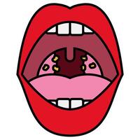 Tonsilitis filled outline icon vector