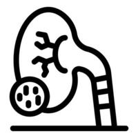 Kidney removing stones with catheter insertion for treatment of urolithiasis vector