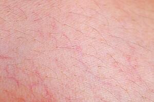 Skin texture with capillary for pattern photo