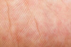 tracery hand skin texture for pattern photo