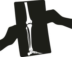 Human leg x-ray medical diagnostic illustration showing bones and joints in black and white style vector