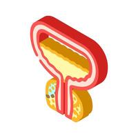 prostatectomy urology isometric icon illustration vector