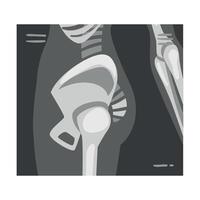 X-ray Film of Coxofemoral Joint Side View Illustrated Image for Educational Purpose vector