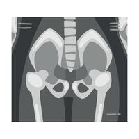 X-ray Film of Coxofemoral Joint Front View Illustrated Image for Educational Purpose vector