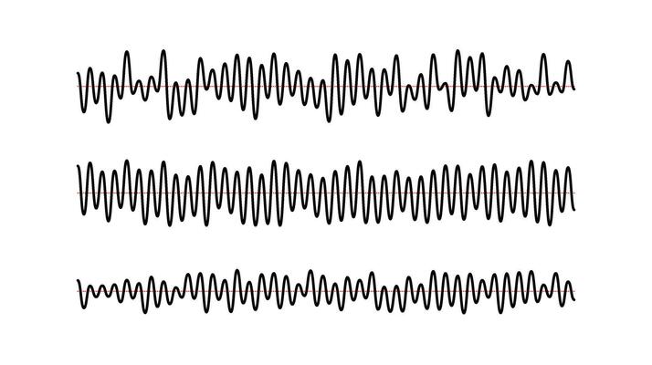 Sound wave signals set. Black audio track beats diagram collection. Voice or music sample concept. Pulse lines. Electronic radio graphics with different frequency and amplitude.