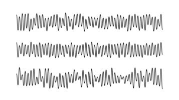 Sound wave signals set. Black audio track beats diagram collection. Voice or music sample concept. Pulse lines. Electronic radio graphics with different frequency and amplitude vector