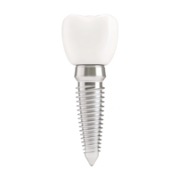 Dental implant with white crown and metallic screw is depicted, showcasing its structure and design. implant is isolated on transparency background, highlighting its details png