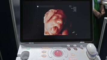 3D Ultrasound Image of Fetus Displayed on Modern Medical Scanner During Prenatal Examination Session video