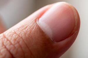 Close-up action of a finger's fingernail indoor setting macro detailed focus skin texture photo