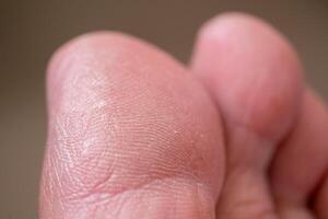 Close-up action of human hand skin texture indoor setting macro detailed view touch sensation photo