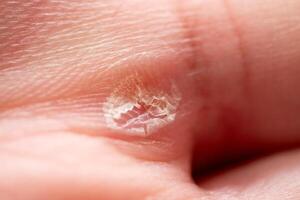Close-up action of healing skin human hand macro indoor environment detailed view health concept photo