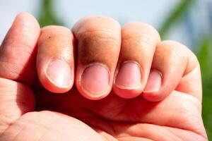 Close-up of human hand with natural nails in bright outdoor setting captured in daylight photo