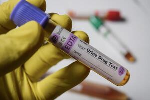 Urine drug - Test with blood sample in yellow gloved hands. healthcare or Medical concept photo