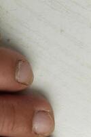 Close-up of the left leg of the alchi on a white background. Pinky is the ring middle toe photo