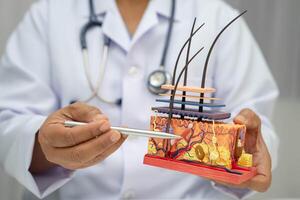 Hair transplant dermatologist doctor holding skin structure anatomy treatment photo