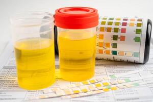 Urinalysis urine cup with reagent strip pH paper test and comparison chart laboratory. photo