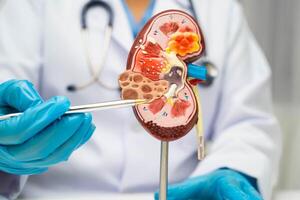 Chronic kidney disease, doctor with model for treatment urinary , urology, Estimated glomerular filtration rate eGFR. photo