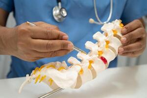 doctor holding spinal nerve and bone model Lumbar spine displaced herniated disc fragment for treatment medical orthopedic photo