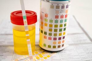 Urinalysis, urine cup with reagent strip pH paper test and comparison chart photo