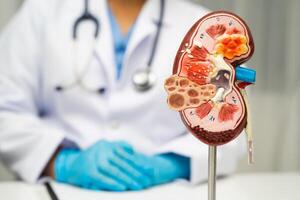 Chronic kidney disease doctor with model treatment urinary system, urology, Estimated glomerular filtration rate eGFR. photo