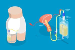 Foley catheter and urine collection system illustration vector