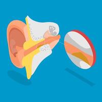 3D Isometric Flat Illustration of Earwax Blockage, Blocked Ear Canal Due To Excess Ear Wax Buildup vector