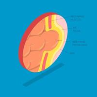 3D Isometric Flat Illustration of Hernia, Health Issues Related To The Abdomen And Intestines vector