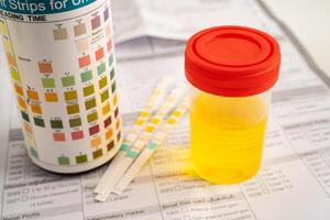 Urinalysis urine cup with reagent strip pH paper test comparison chart photo