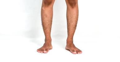 Close-up of a person's hairy legs and bare feet standing on a white surface highlighting a skin condition photo