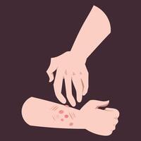 Human arm scratching itchy skin because of bug bites. Hives or bumps on hand arm. Simple flat colorful drawings isolated on square dark background. vector