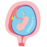 The placenta is a temporary organ that develops in the uterus. vector