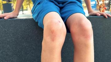Child has scrapes on knees while sitting outside at a park during warm weather in the afternoon video