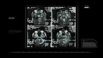Brain Scan Visualization Animation Footage for Medical and Scientific Use video
