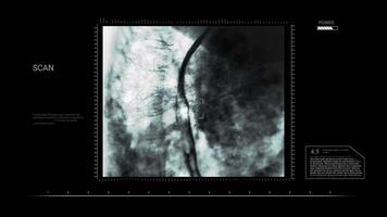 X Ray Elements Animation Footage for Medical and Scientific Use video