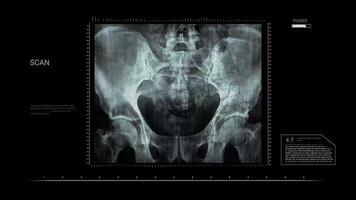 Pelvis X Ray Animation Footage Showing Human Bone Structure video