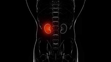 Kidney Stone Animation with Black Screen video