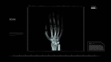 Hand X Ray Animation Footage with Transparent or Dark Background video
