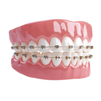 Human Teeth with Braces. Isolated on Transparent Background for Orthodontics, Dental Care, Smile Correction, and Medical Education Design Concepts png
