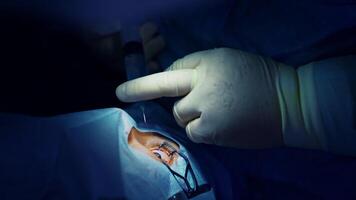 Laser vision correction, patient and team of surgeons in the operating room during ophthalmic surgery. Eyelid speculum. Lasik treatment. Patient under sterile cover video