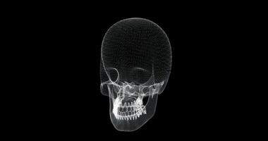 Hologram screen 3d of skull bones in the human body - loop video